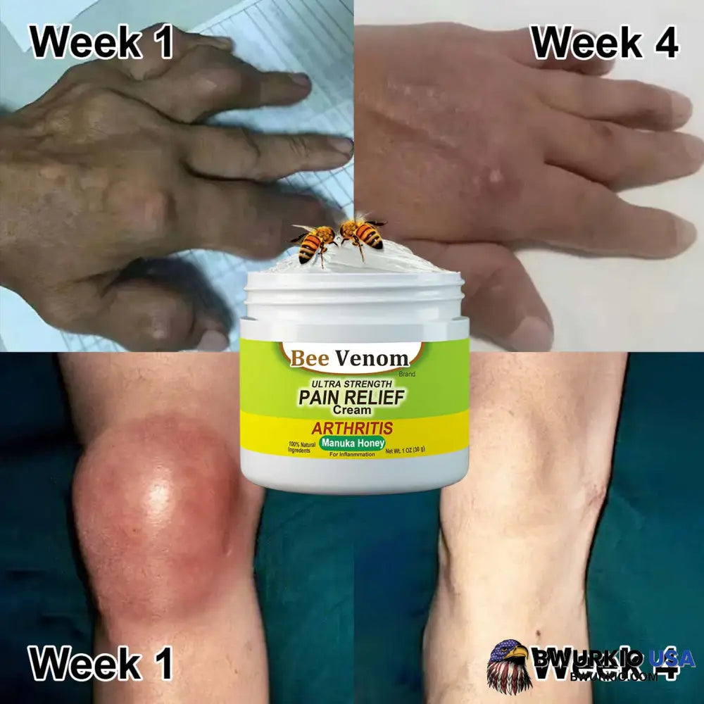 New Zealand Bee Venom Joint And Bone Therapy Advanced Cream